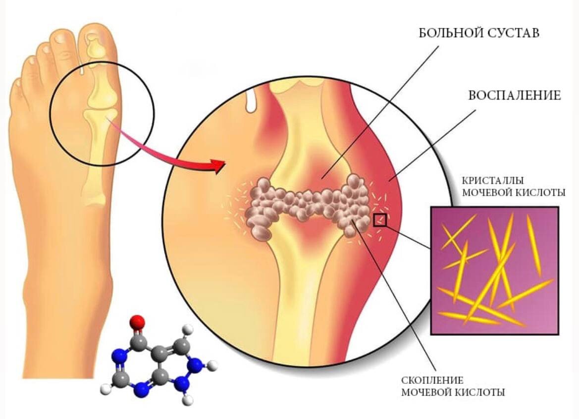 ������� �������, ��� ���, ������ ��������� ������� ��� ������ ������ ���������? ������� �����������. ���� �� ���� ������� ������� � ��� �������� (������, ���� ��) �������Pur������� ������.-2