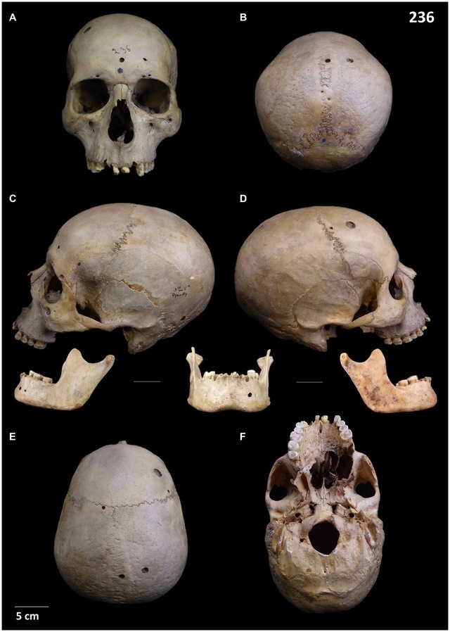 Череп 236.