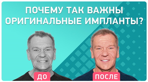 Почему нужно использовать только оригинальные компоненты от имплантов? 👉 История пациента