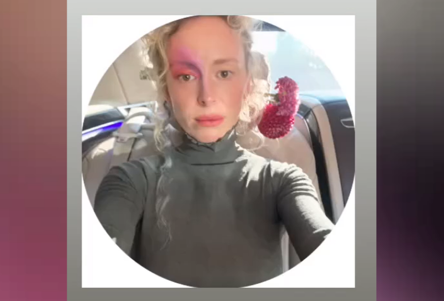 -6