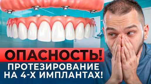 ВСЕ НА 4-х- ДОРОГОСТОЯЩАЯ ОШИБКА ИЛИ РЕВОЛЮЦИОННОЕ ПРОТЕЗИРОВАНИЕ?