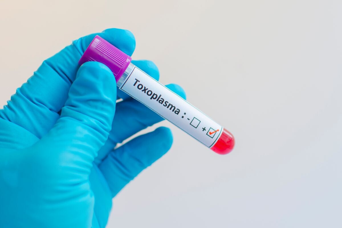 Toxoplasma тест 