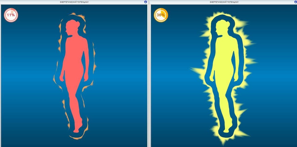 Диагностика в програме Лотос-Оникс