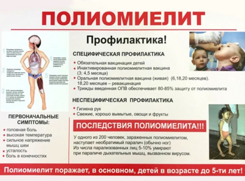 Полиомиелит. Симптомы и последствия.