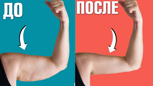 Обвисла кожа на руках, дряблость? ПОДТЯНИ кожу на руках за 1 упражнение. Упражнение "ЧАЙКА" для рук | Школа Молодости и Здоровья - Времени Нет