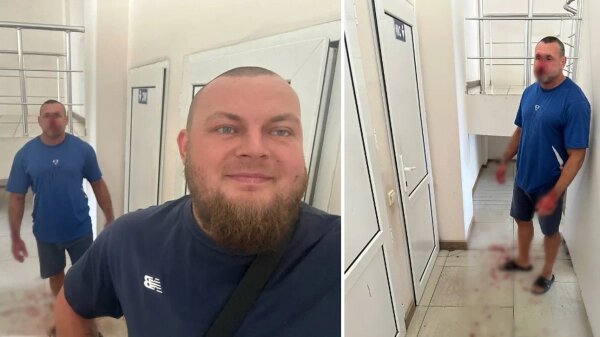 Прибывший по зову военкомов Демьян Ганул делает селфи на фоне избитого тренера. Фото © Telegram / GANUL