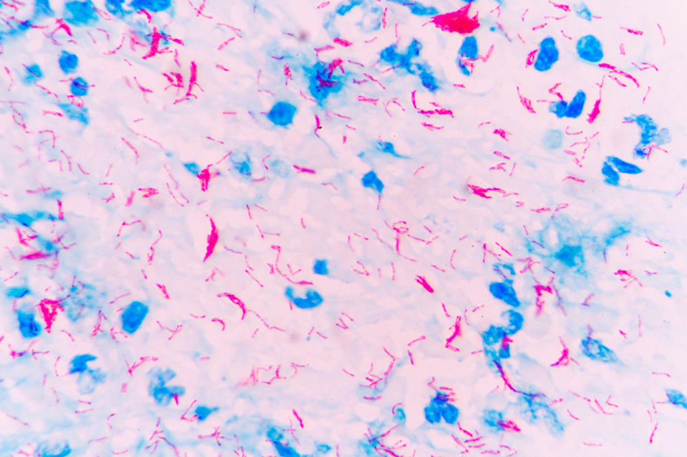 Mycobacterium tuberculosis. Иллюстрация: rockefeller.edu