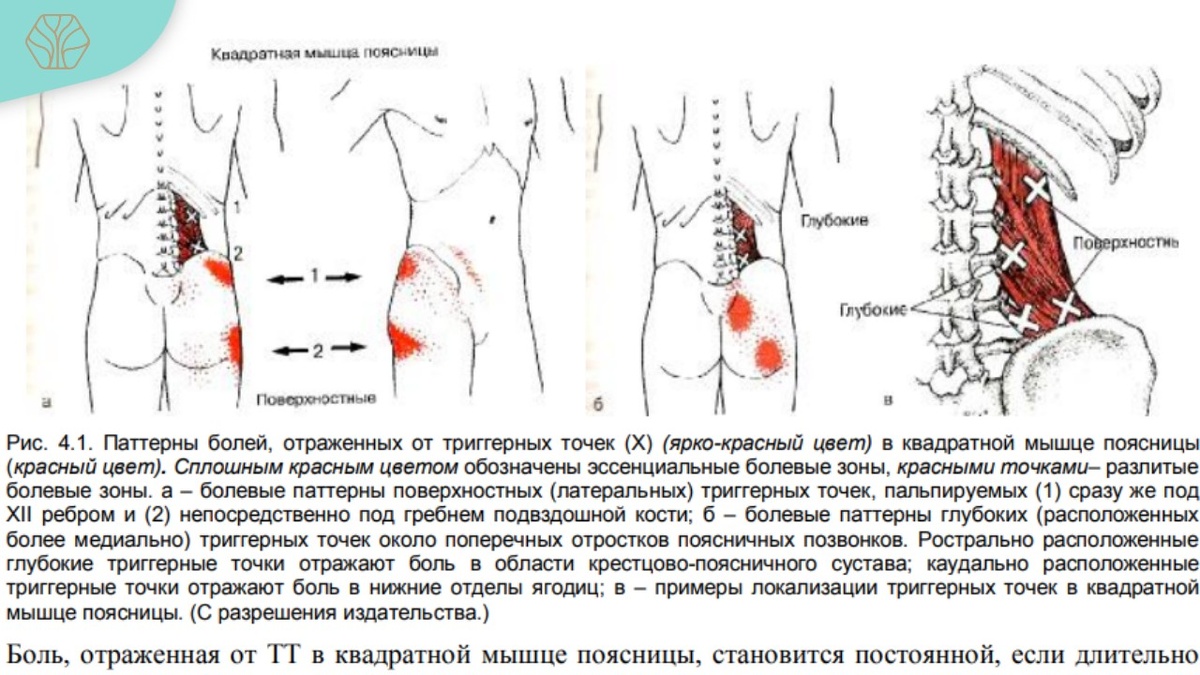 Скрин из книги Джанет Трэвелл "Миофасциальные боли и дисфункции". Том 2. 