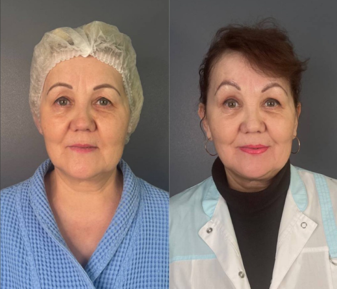 Авторское фото