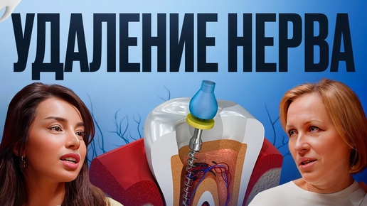 УДАЛЕНИЕ НЕРВА ЗУБА 🤯 Причины и последствия удаления ✅❌ Лечение пульпита и зубных каналов 💉