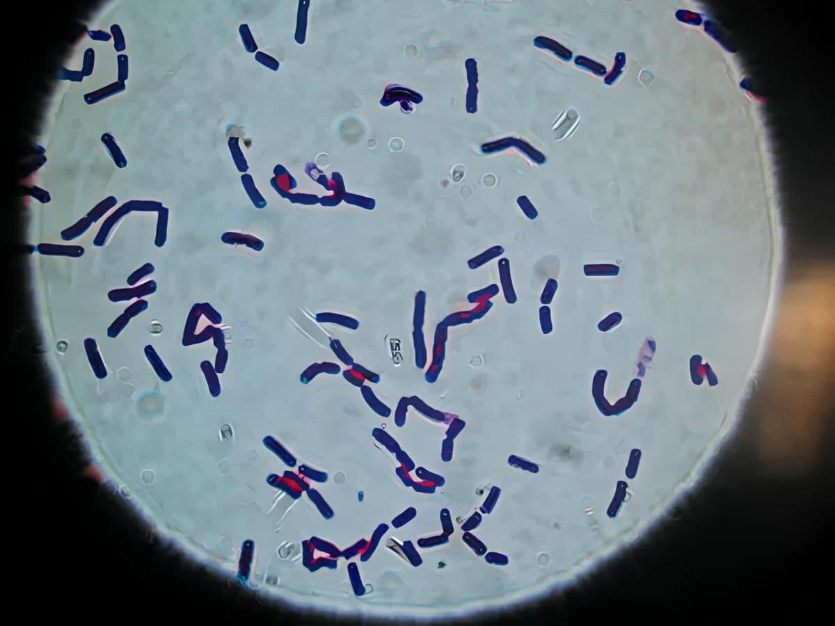    Вид грамположительных, спорообразующих почвенных бактерий Bacillus cereus под микроскопом / © BCCDC Labs