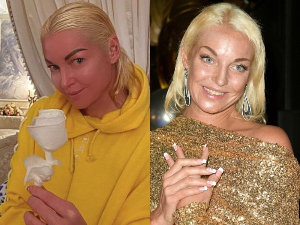    Анастасия Волочкова. Кажется, мы начали забывать, как когда-то выглядели нарисованные будто бы фломастером брови и ресницы-крылья балерины. Она научилась оставлять все преувеличения в прошлом. Ладно, с бровями мы поторопились, но с ресницами Анастасия научилась держать себя в руках. Фото: соцсети