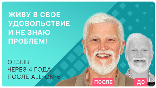 В чем секрет молодости и долголетия? Рассказываю свою историю про имплантацию зубов