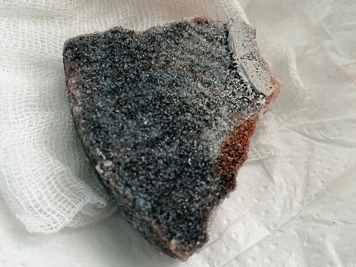    Осколок абразивного диска, извлеченный врачами Центра травматологии из черепа пациента во время операции в Кирове© Фото : Министерство здравоохранения Кировской области