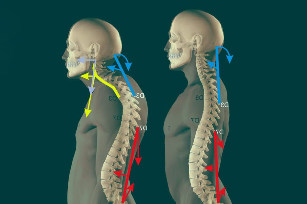Нарушения в шейном отделе, которые приводят к проблемам со всем скелетом