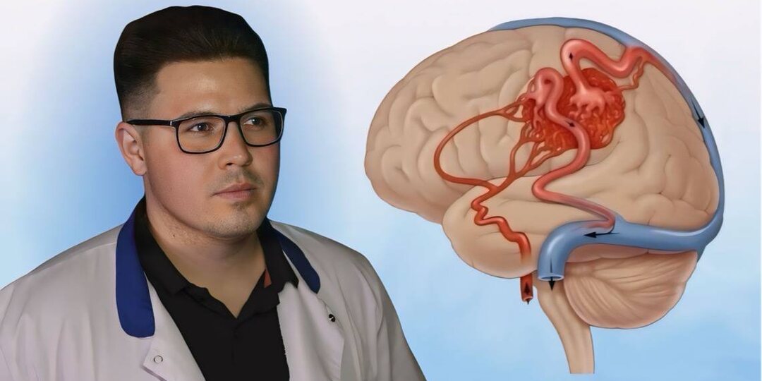 Топ 3 способа улучшить кровообращение головного мозга