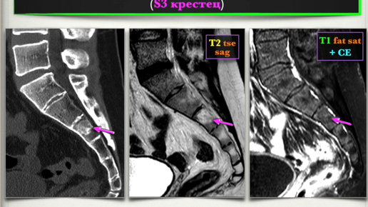 Интерактивные случаи спинальной патологии