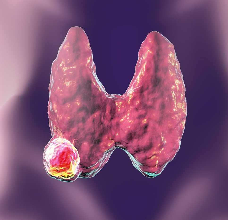 Изображение получено из свободного доступа