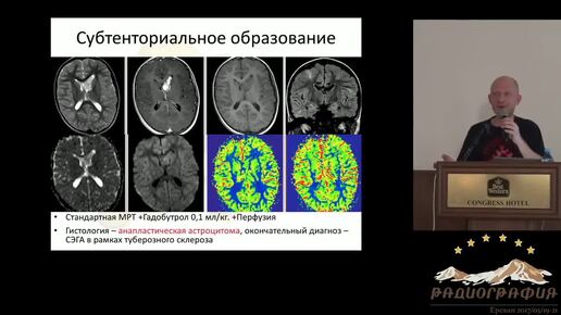 Гистологическая верификация - такой ли уж золотой 