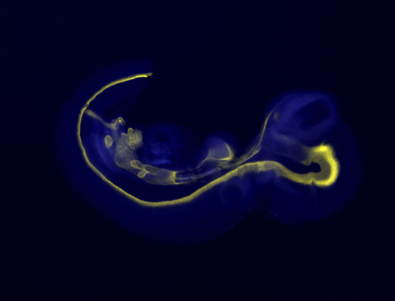 Developing neural tube («Развивающаяся нервная трубка плода»). NIMR, MRC. Источник: Wellcome Collection