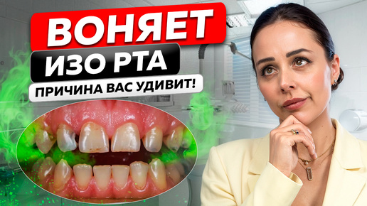 Download Video: Это вам никто не расскажет! СТОМАТОЛОГ ОТВЕЧАЕТ НА ВОПРОСЫ: все, что вы хотели знать о зубах