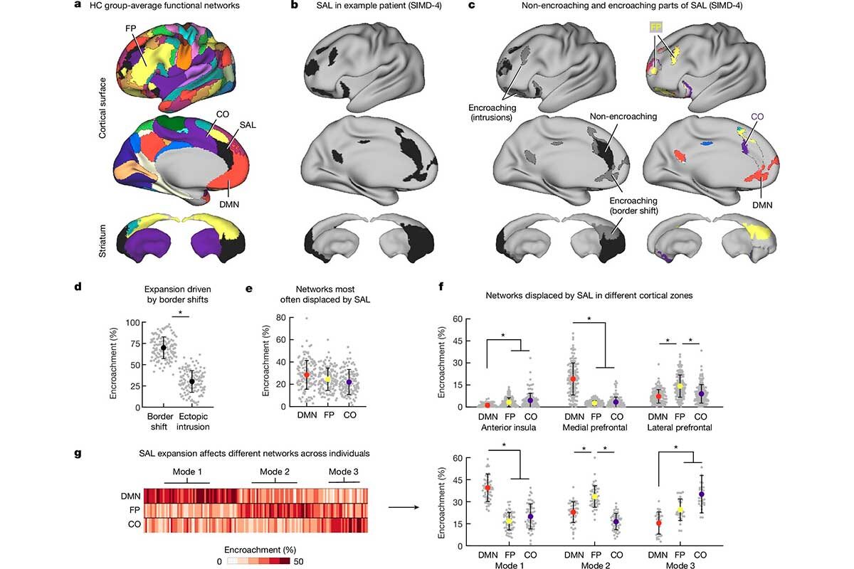 Nature📷Три режима расширения сети значимости при депрессии