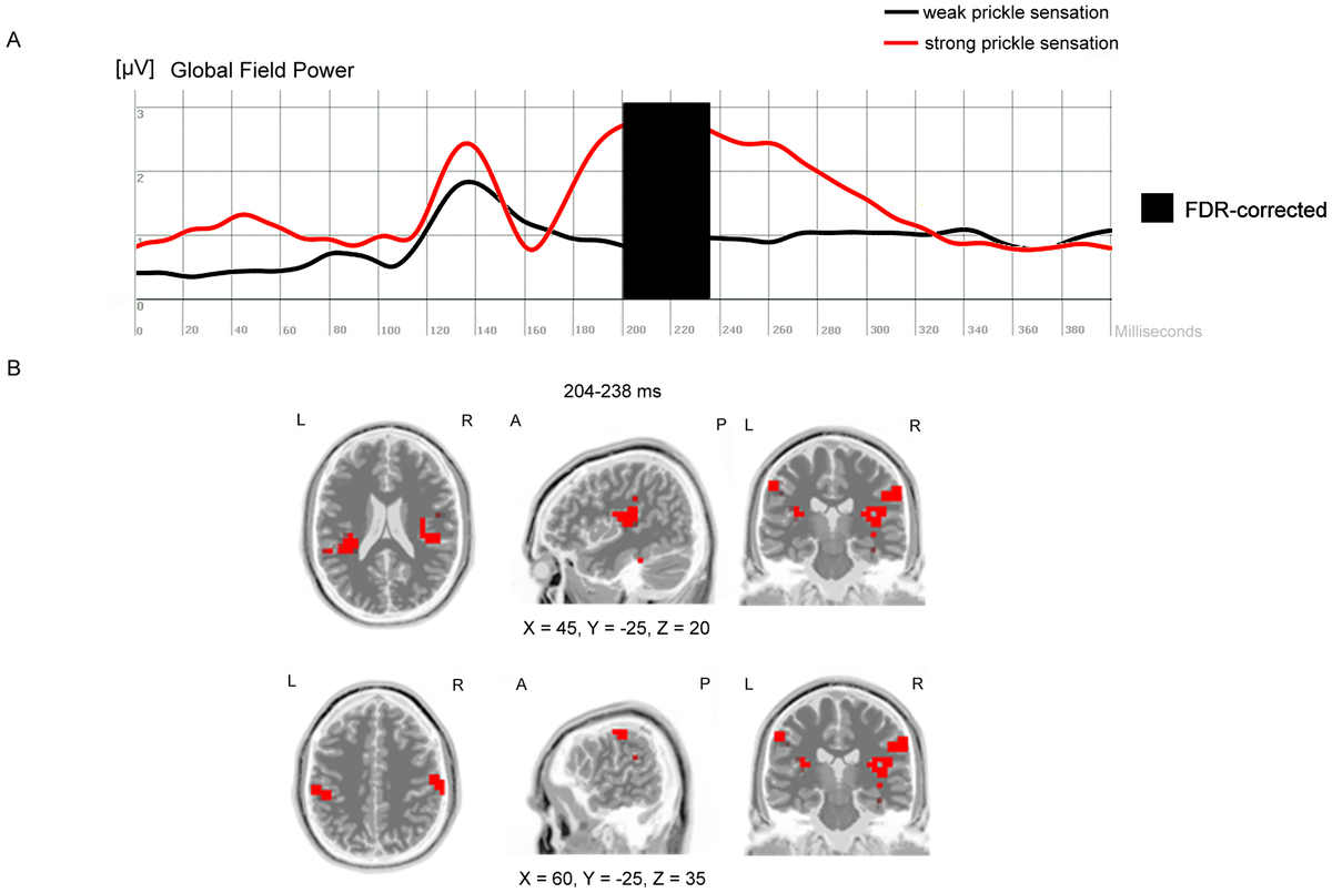    Nicolas Langer, Gian Beeli, Lutz Jäncke; Plosone; DOI: https://doi.org/10.1371/journal.pone.0009208 CC-BY 4.0