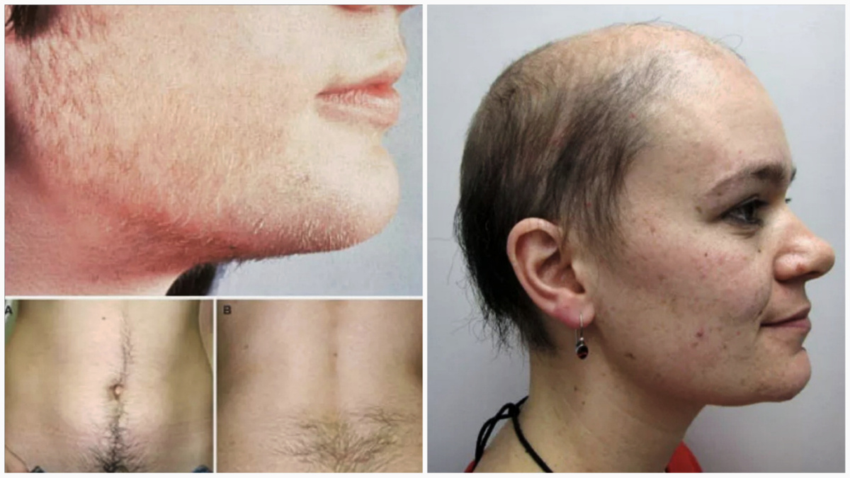 Очень неприятные симптомы, согласитесь?