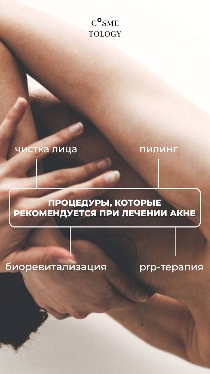 Но перед  процедурой важно найти грамотного косметолога, на консультации разобрать проблему и выяснить истинную причину проявления акне