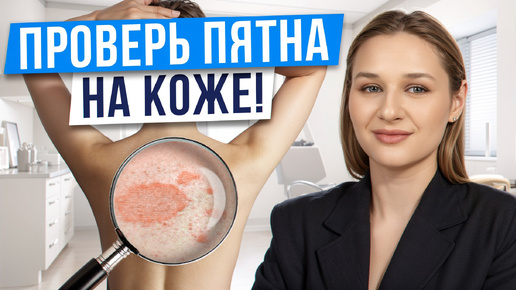 ПЯТНА НА КОЖЕ после ЛАЗЕРА! / Как ЛЕЧИТЬ отрубевидный лишай?