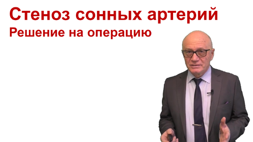 Стеноз сонной артерии: оперировать?