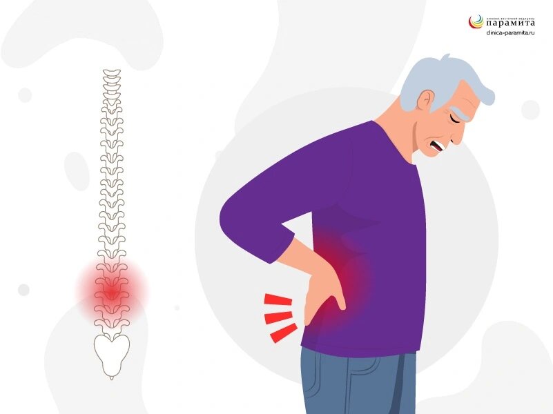 Локализация поясничной грыжи 
