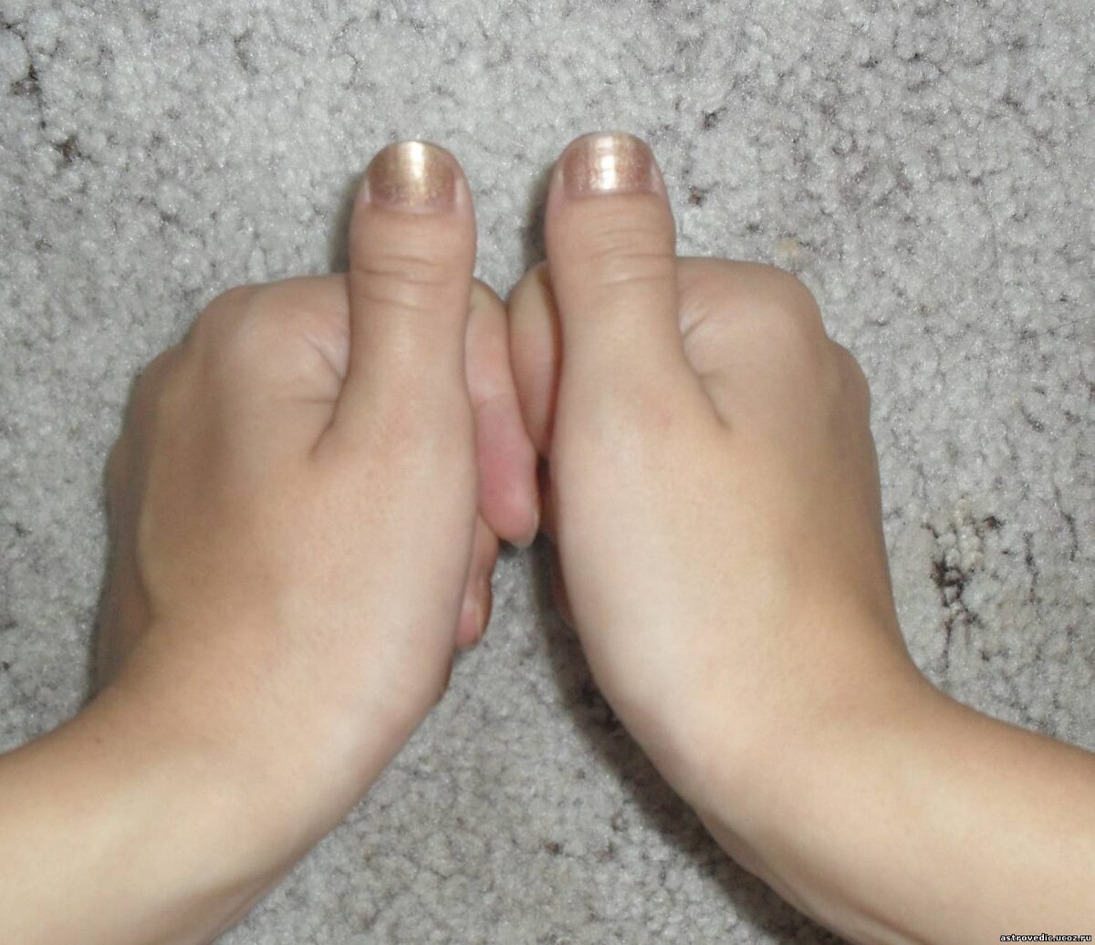 Булавовидный палец