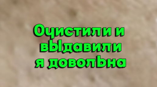 Извлекаем ПРЫЩИ с лица и кожи