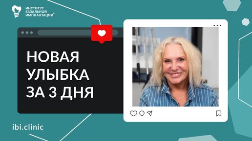 Базальная имплантация спасла ситуацию и вернула здоровую улыбку | Отзыв спустя три года