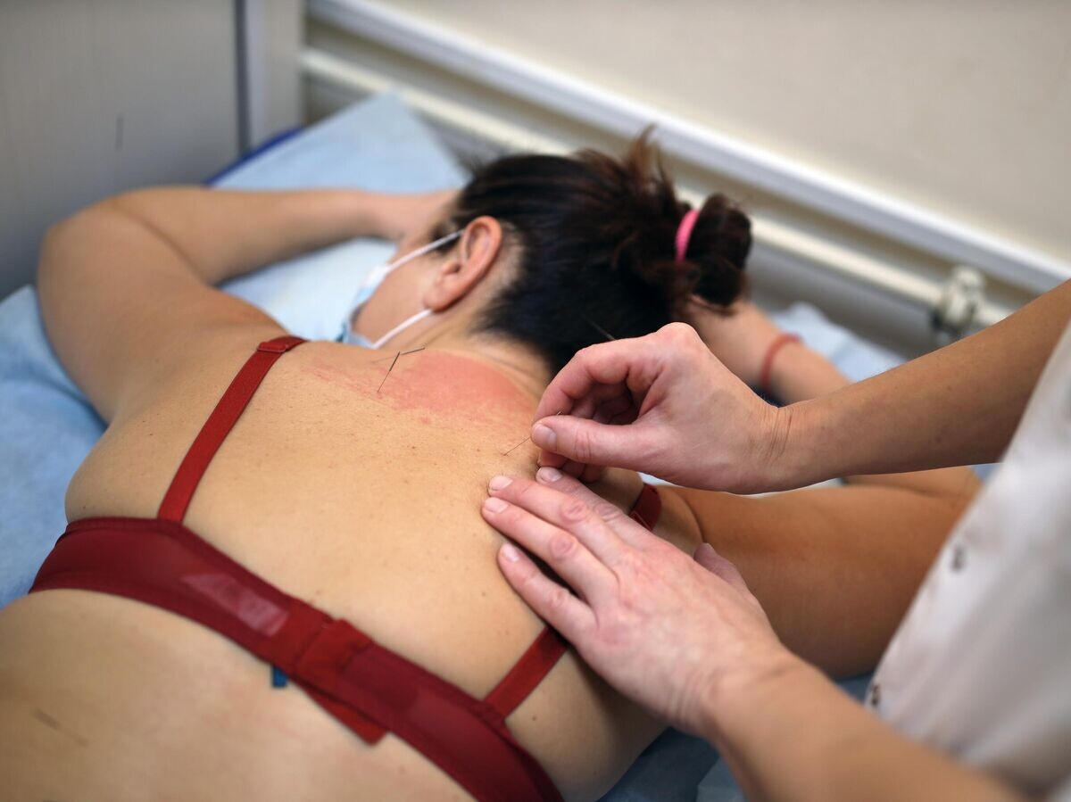    Женщина во время иглорефлексотерапии© РИА Новости / Виталий Тимкив