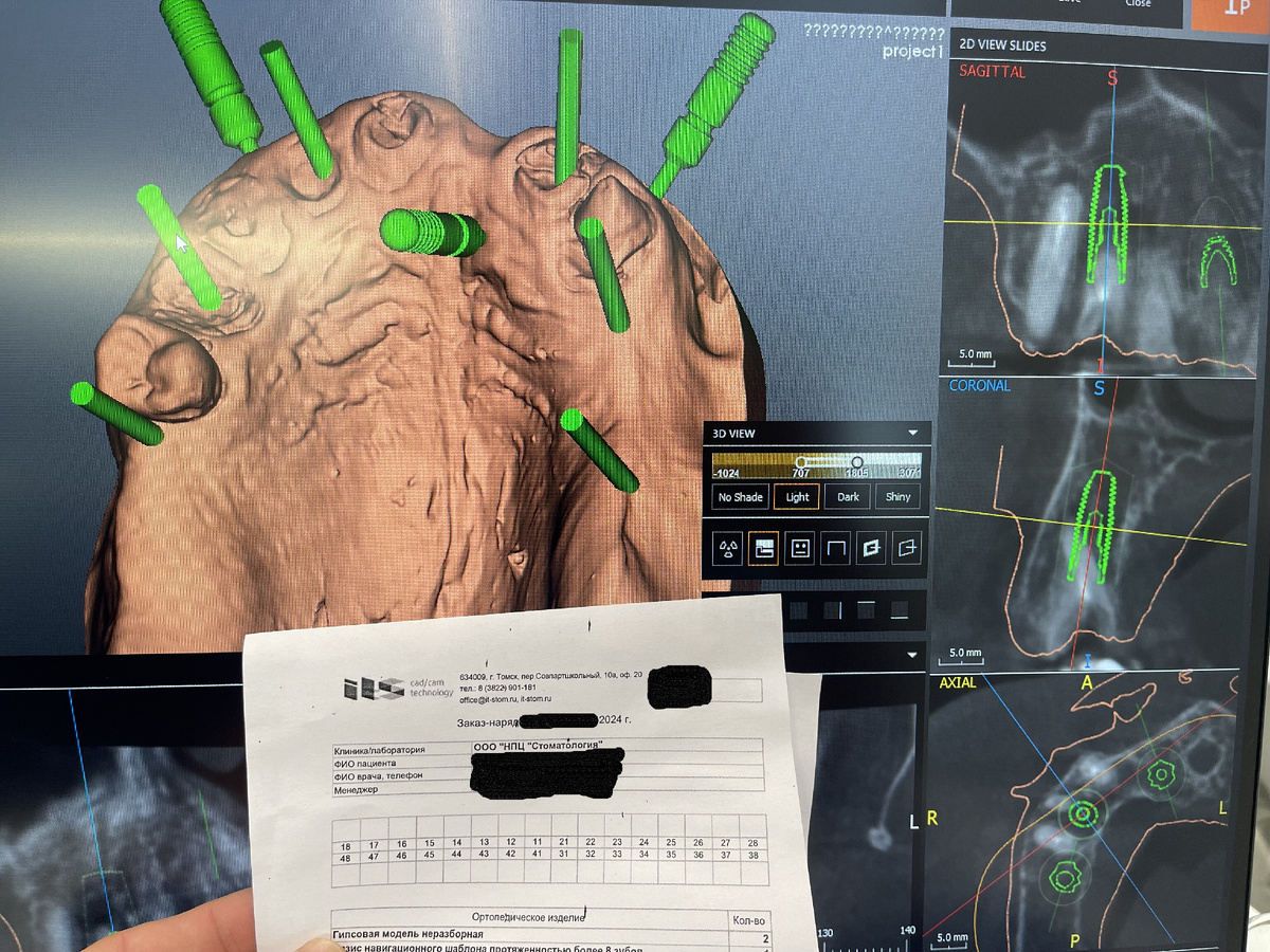 Просто планирование тотала все-на-6
