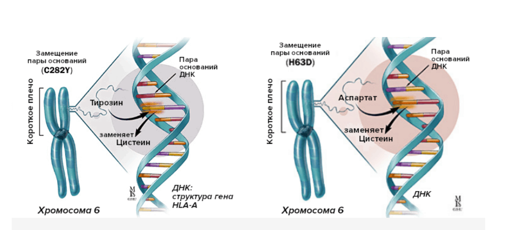 Поломка гена на 6 хромосоме является причиной гемохроматоза. Она возникает при замене цистеина на тирозин, или реже при замене цистеина аспаратом. 