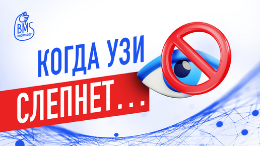 ЭУС: Артефакты #эндосонография #эус #эндоузи #узи #ультразвуковаядиагностика