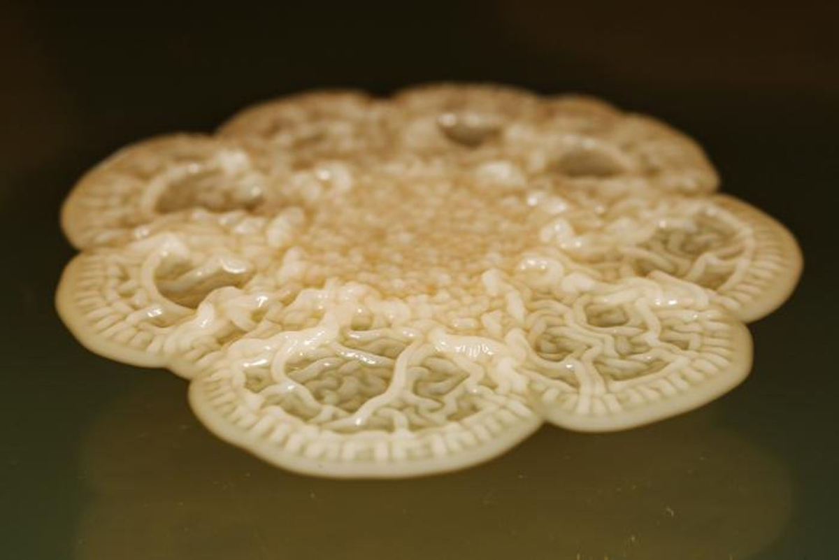 Колония Corynebacterium matruchotii, одной из самых распространенных бактерий в зубном налете. Фото: Скотт Чимилески, Морская биологическая лаборатория. / Чимилески и др., PNAS, 2024.