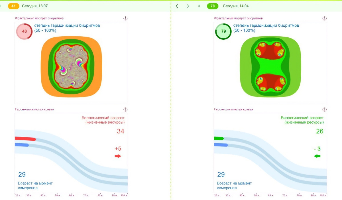 Диагностика в программе Лотос-Оникс