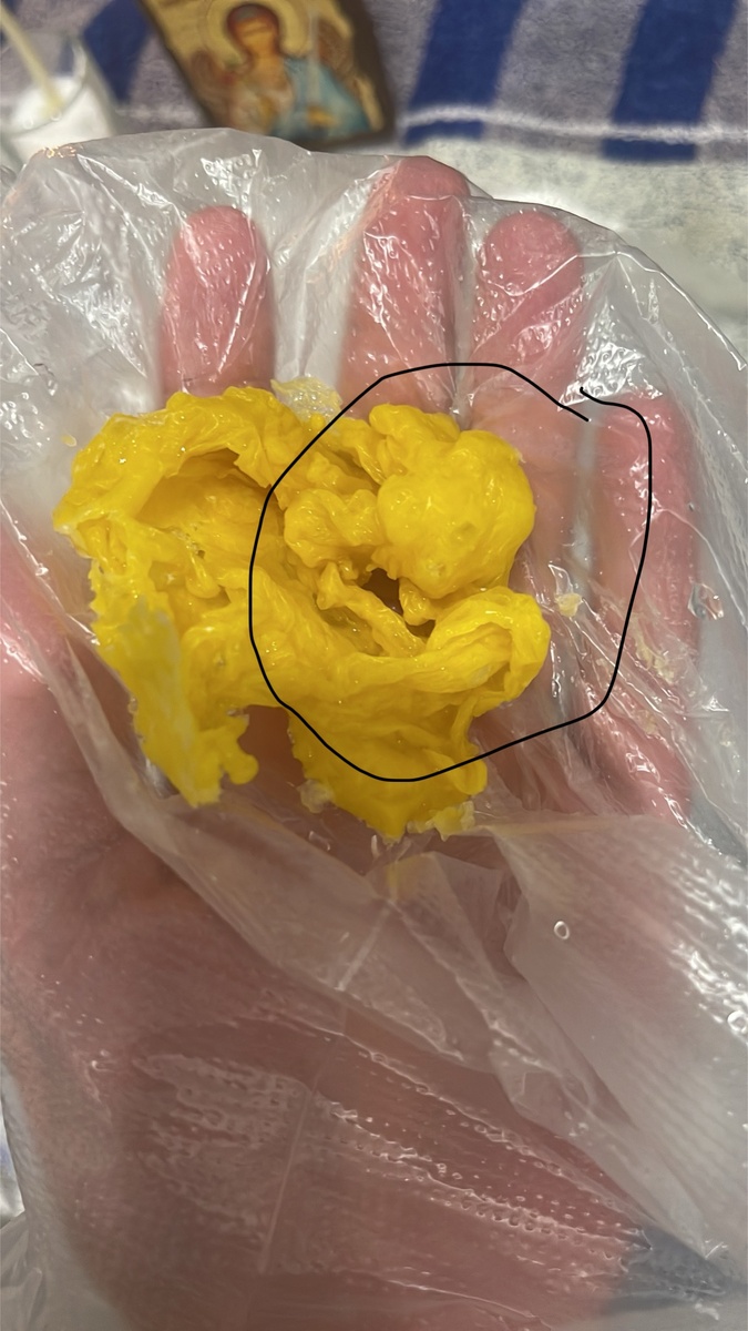 Не рожденный ребёнок 