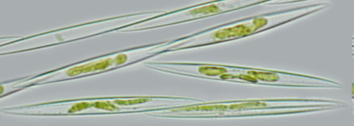 Зомбо кислота (домоевая кислота). Цветение воды и его последствия.