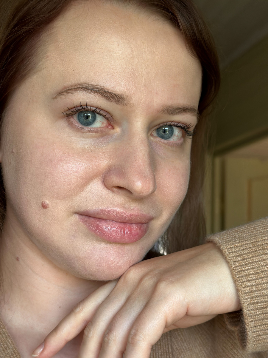 Вот так выглядят губы в данный момент.