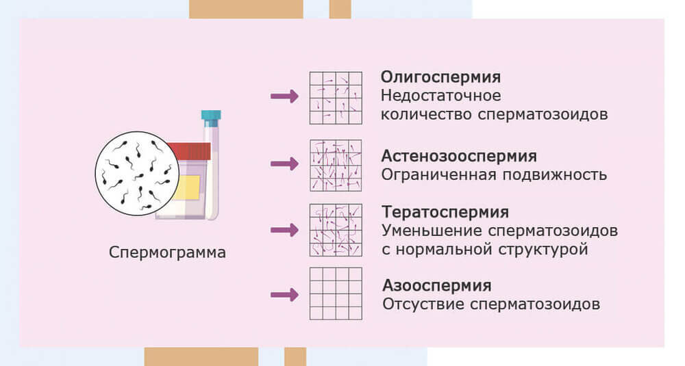 Нарушения эякулята