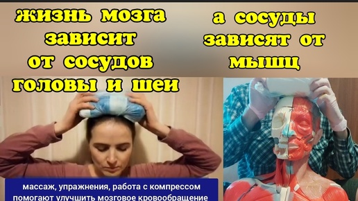 Download Video: Инсульт: как спасти сосуды мозга? Методы предотвращения инсульта