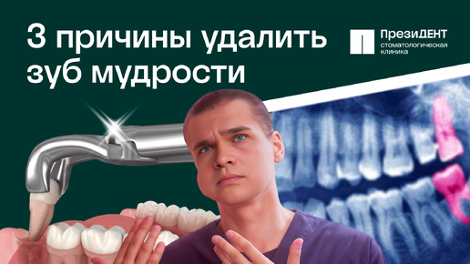 Скачать видео: 🦷 Зуб мудрости - удалять или нет? Три главных причины для удаления зуба мудрости!