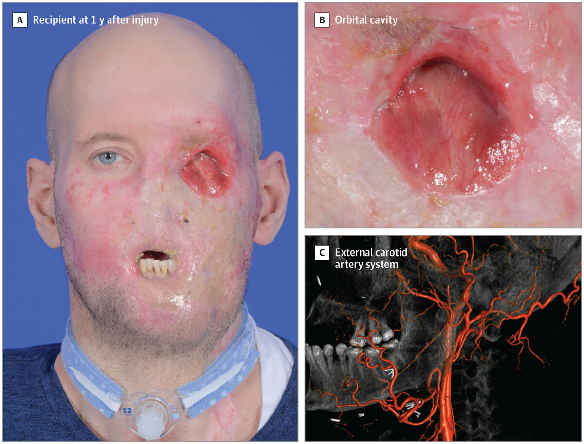   Daniel J. Ceradini et al. / JAMA, 2024