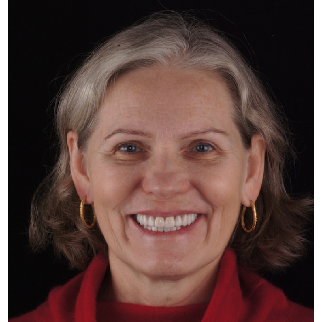 Пациентка до и после лечения