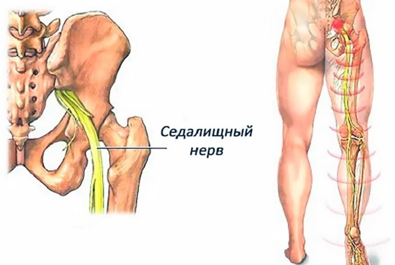 Как по боли в ногах определить причину? (4 вида боли)